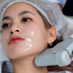 Lower Lip/chin Hair Removal Treatment by Diode laser