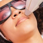 Upper lip Hair Removal Treatment